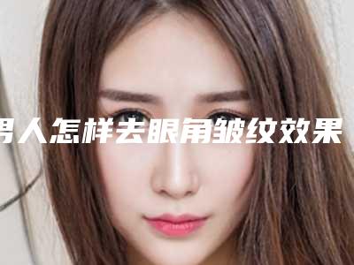男人怎样去眼角皱纹效果好(男人怎样去眼角皱纹效果好图片)