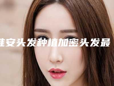 淮安头发种植加密头发最长能管多久