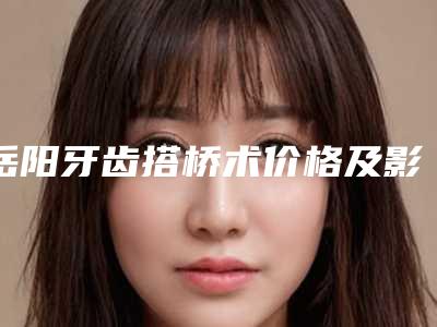 岳阳牙齿搭桥术价格及影响因素